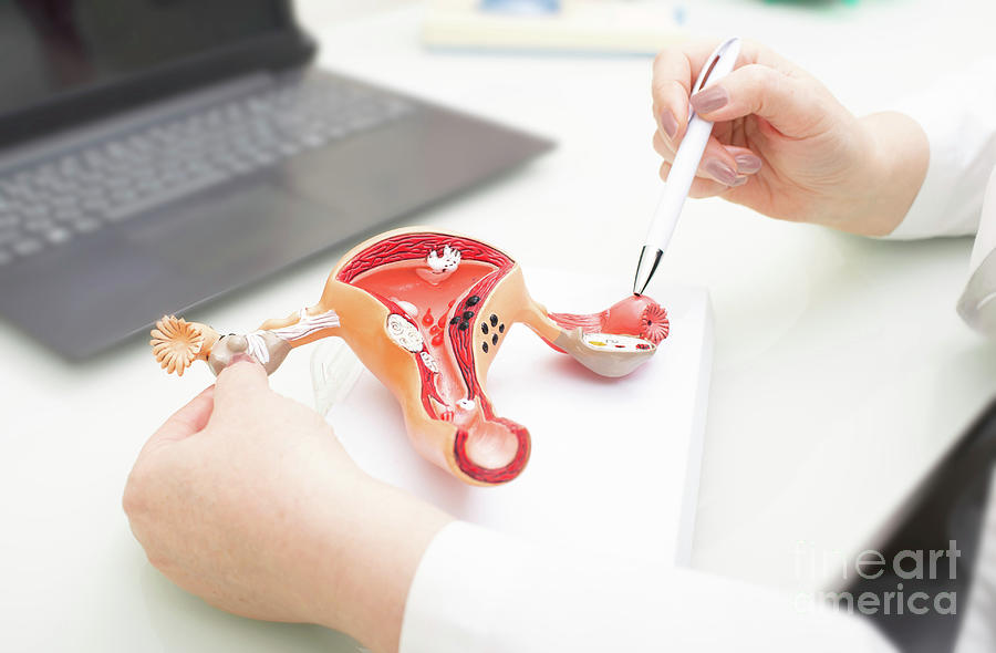 Female Reproductive Disorders Photograph By Peakstock Science Photo