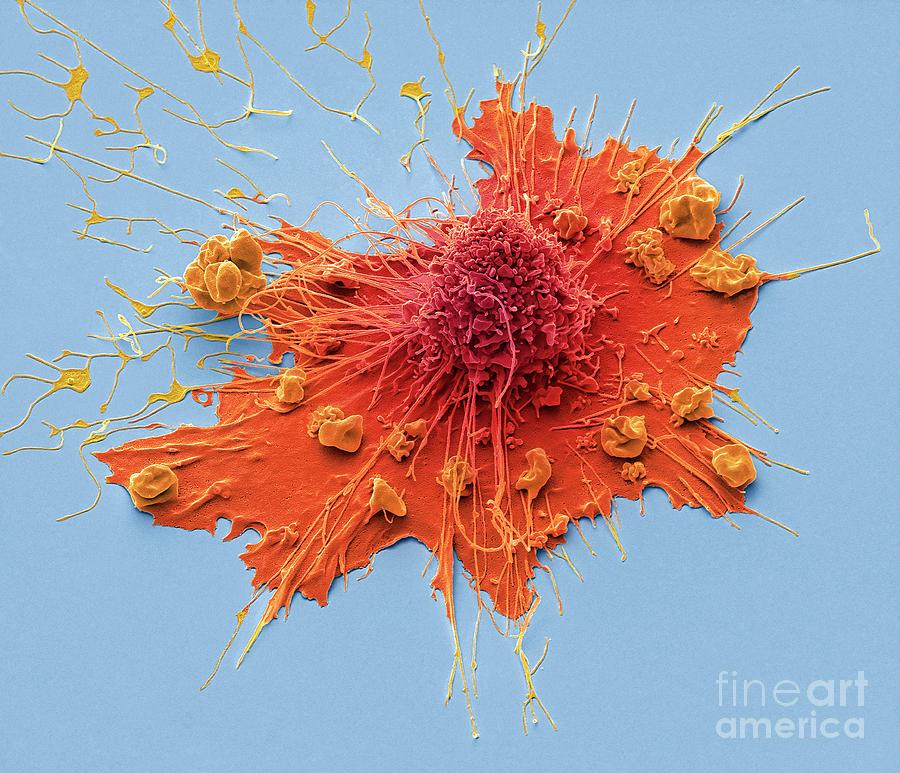 Fibroblast Cell #4 Photograph by Steve Gschmeissner/science Photo Library