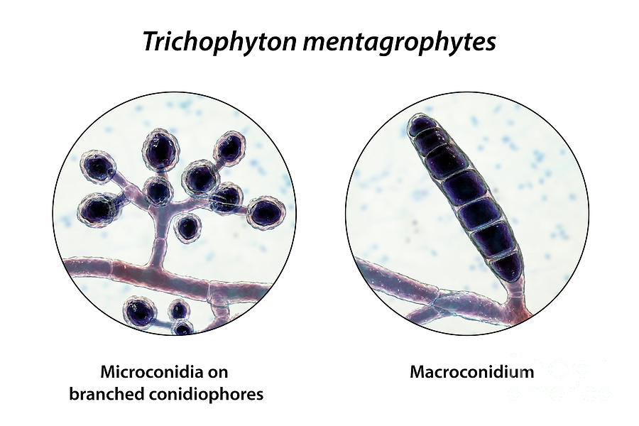 Fungi Trichophyton Mentagrophytes Photograph by Kateryna Kon/science ...