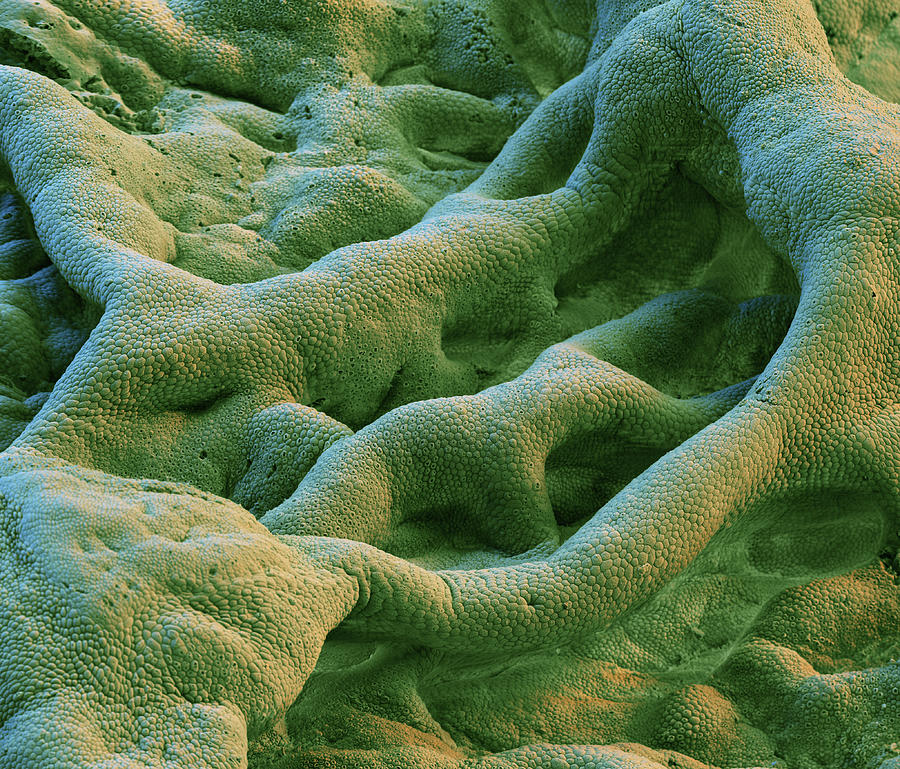 Gallbladder, Sem #4 Photograph by Eye Of Science
