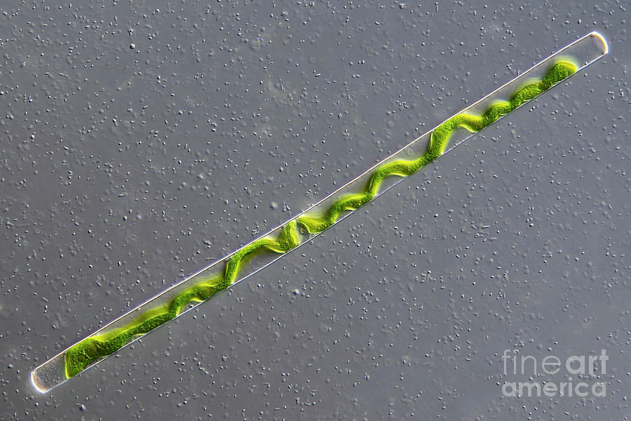 Gonatozygon Kinahanii Algae #4 Photograph by Frank Fox/science Photo Library