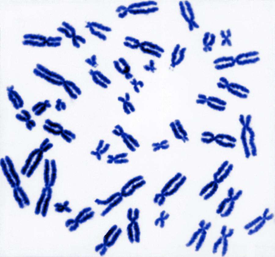 Human Chromosomes #4 Photograph by Biophoto Associates