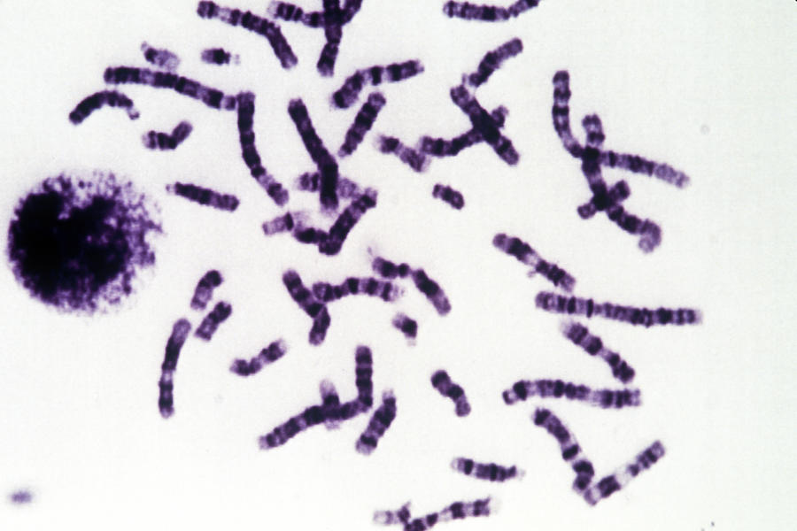 Human Chromosomes #4 Photograph by Meckes/ottawa