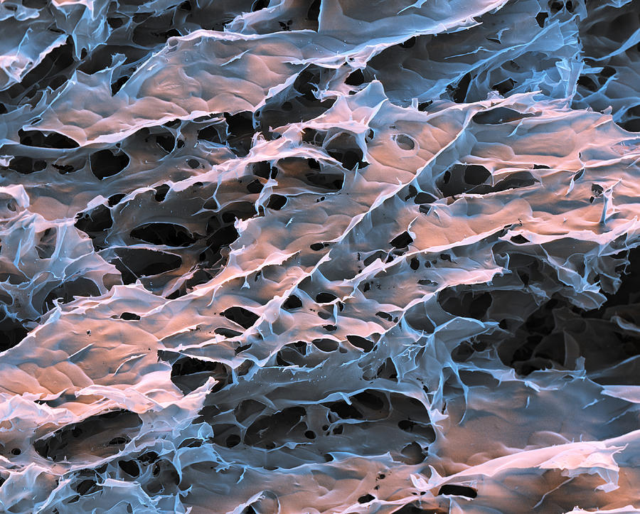 Hydrogel Of Synthetic Spider Silk, Sem #4 Photograph by Meckes/ottawa