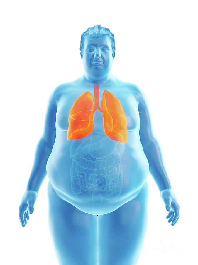 3d Photograph - Illustration Of An Obese Mans Lungs #4 by Sebastian Kaulitzki/science Photo Library