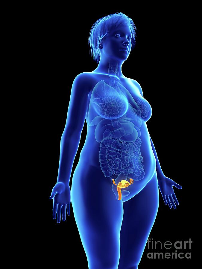Illustration Of An Obese Womans Uterus #4 Photograph by Sebastian Kaulitzki/science Photo Library