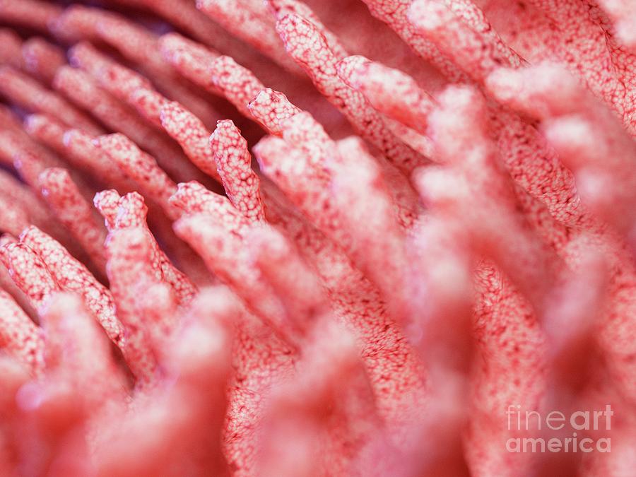 Illustration Of Inflamed Intestinal Villi Photograph by ...