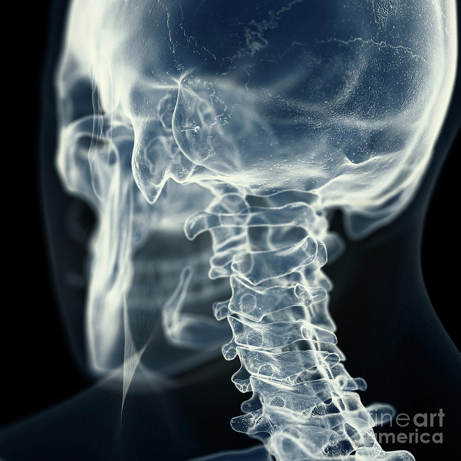 Illustration Of The Cervical Spine Photograph by Sebastian Kaulitzki ...