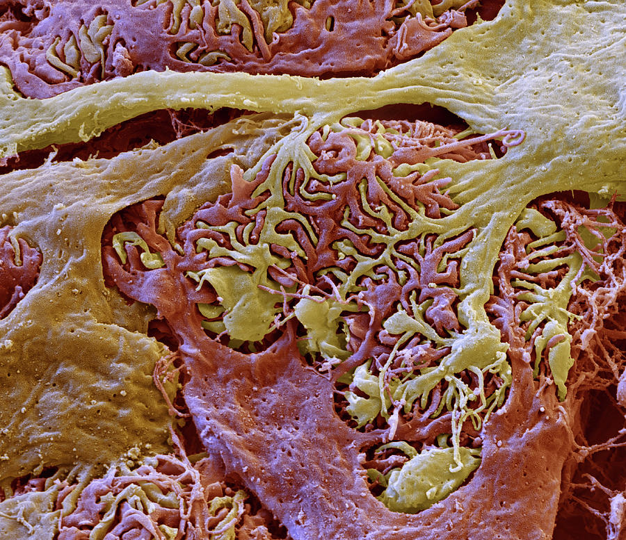 Kidney Glomerulus, Sem #4 Photograph by Oliver Meckes EYE OF SCIENCE