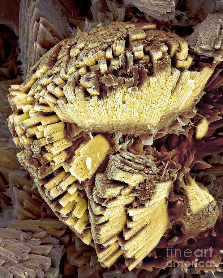 Kidney Stone #4 Photograph by Dennis Kunkel Microscopy/science Photo Library