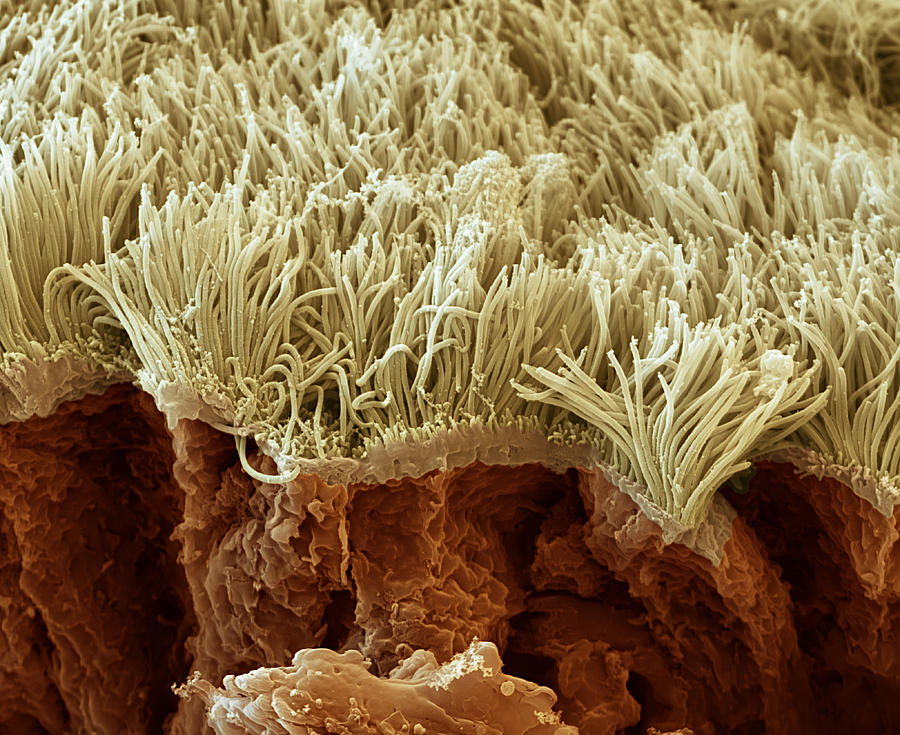 Lung Lining Sem #4 Photograph by Meckes/ottawa