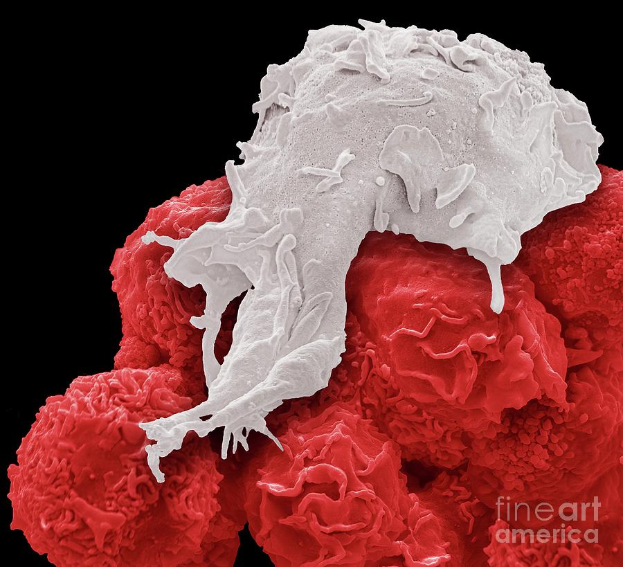 Macrophage And Cancer Cells #4 Photograph by Steve Gschmeissner/science Photo Library