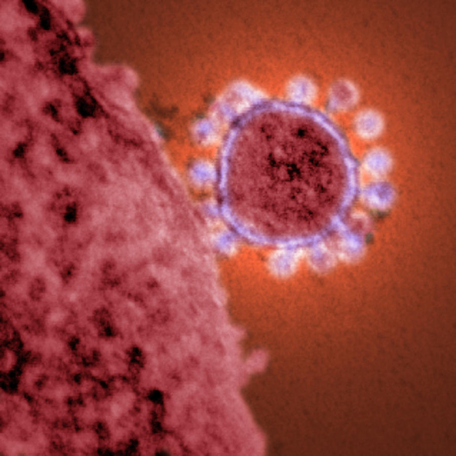 Mers Coronavirus, Tem #4 Photograph by Science Source