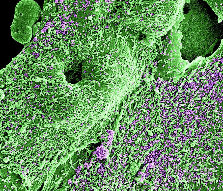 Mers Virus Particles #4 Photograph by Niaid/science Photo Library