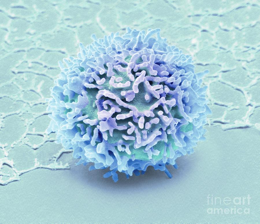 natural-killer-cell-photograph-by-steve-gschmeissner-science-photo