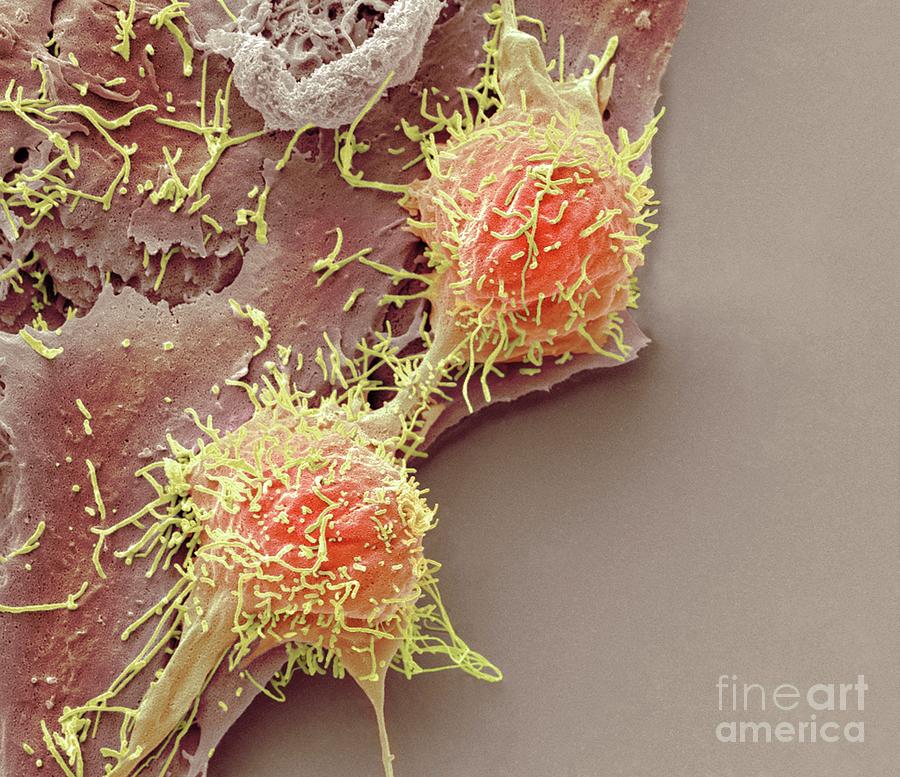 Natural Killer Cells And Cancer Cell Photograph by Steve Gschmeissner ...