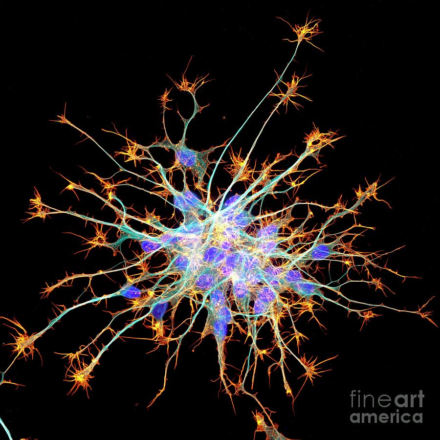 Neurons From Stem Cells Photograph by Dr Torsten Wittmann/science Photo Library