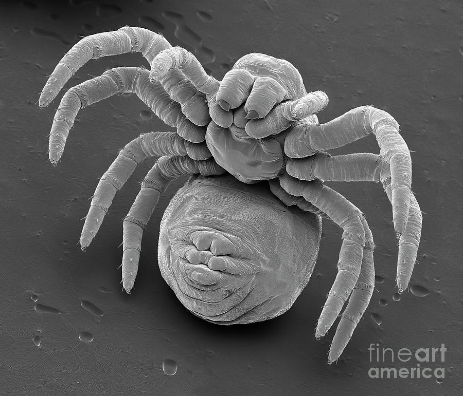 Newly Hatched Spiderling #4 Photograph by Steve Gschmeissner/science Photo Library