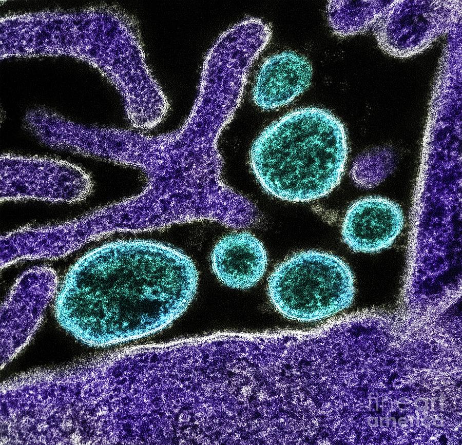 Nipah Virus #4 Photograph by Niaid/science Photo Library