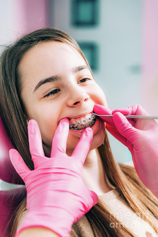 Orthodontist Fixing Girls Dental Braces 4 Photograph By Microgen Imagesscience Photo Library 8195