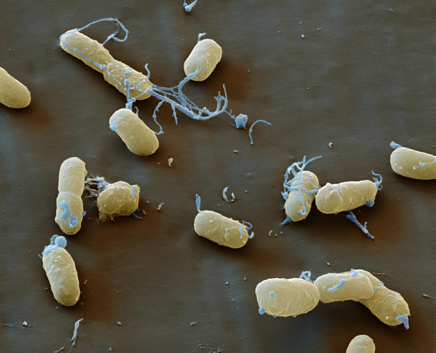 Plague Bacteria Yersinia Pestis, Sem #4 Photograph by Meckes/ottawa
