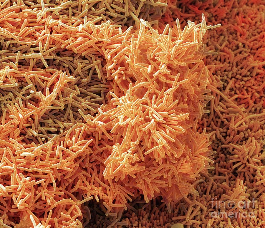 Plaqueforming Bacteria Photograph by Steve Gschmeissner/science Photo Library Pixels
