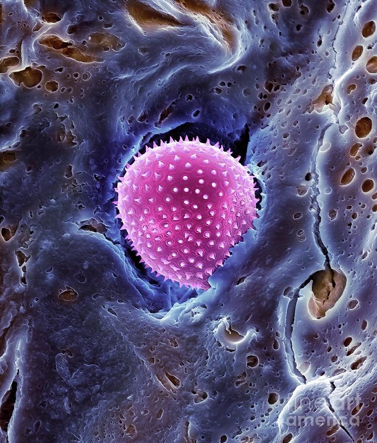 Pollen Trapped In Mucus On Nose Hair #4 Photograph by Dennis Kunkel Microscopy/science Photo Library