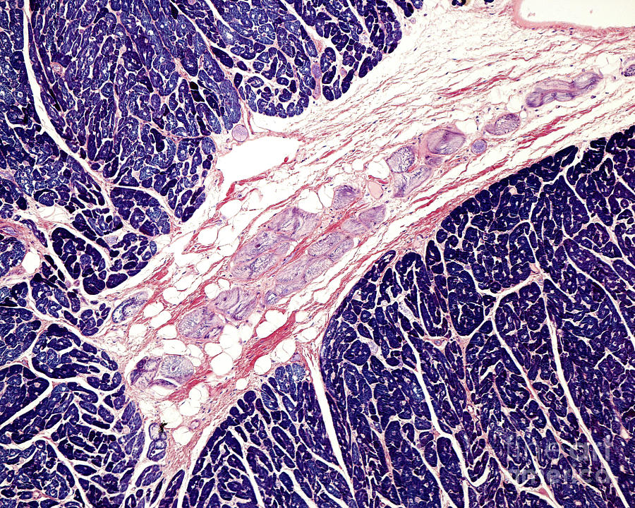purkinje fibers histology