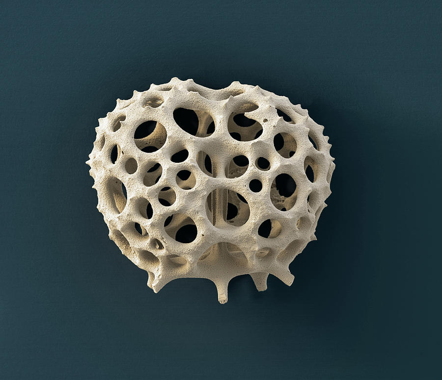 Radiolarian, Sem #4 Photograph by Oliver Meckes EYE OF SCIENCE
