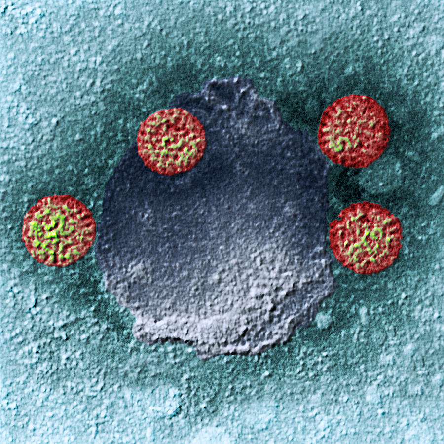 Rotavirus Particles, Tem #4 Photograph by Meckes/ottawa
