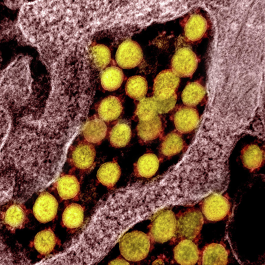 Sars-cov-2, Covid-19 Virus, Tem Photograph by Science Source | Fine Art ...