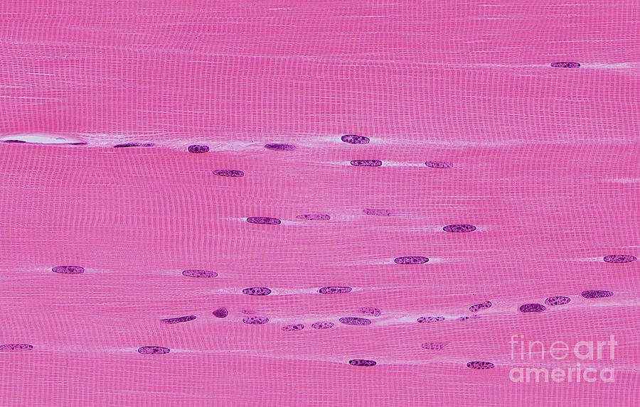 Skeletal Muscle #4 Photograph by Microscape/science Photo Library
