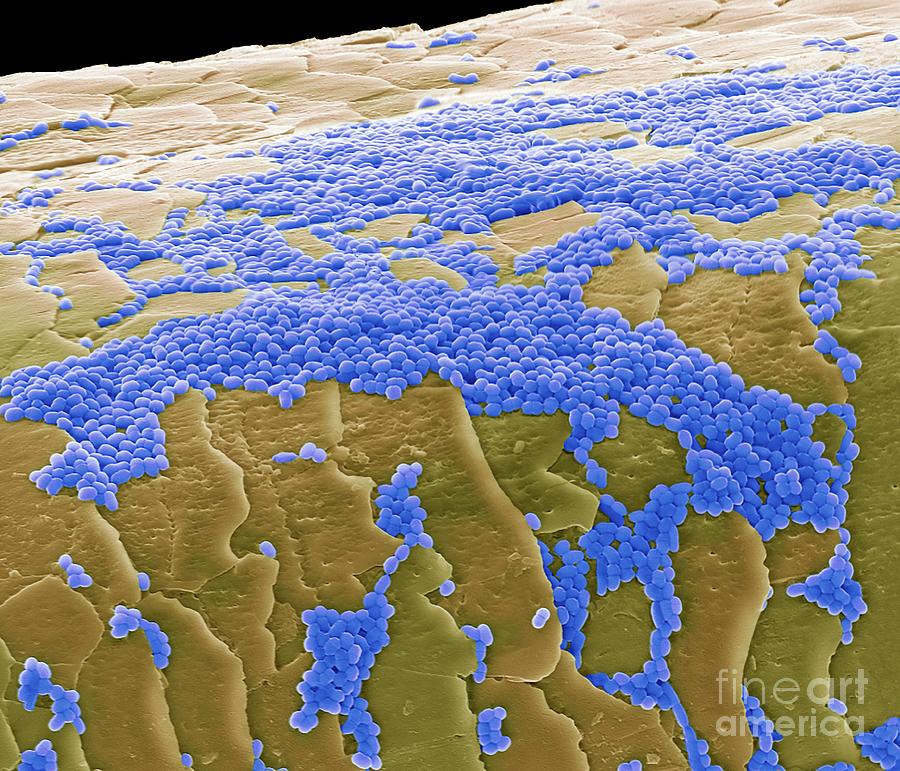 Skin Bacteria On Hair Photograph by Steve Gschmeissner/science Photo ...