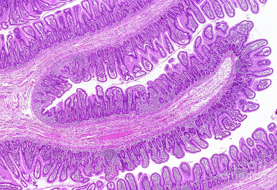 Small Intestine #4 by Microscape/science Photo Library