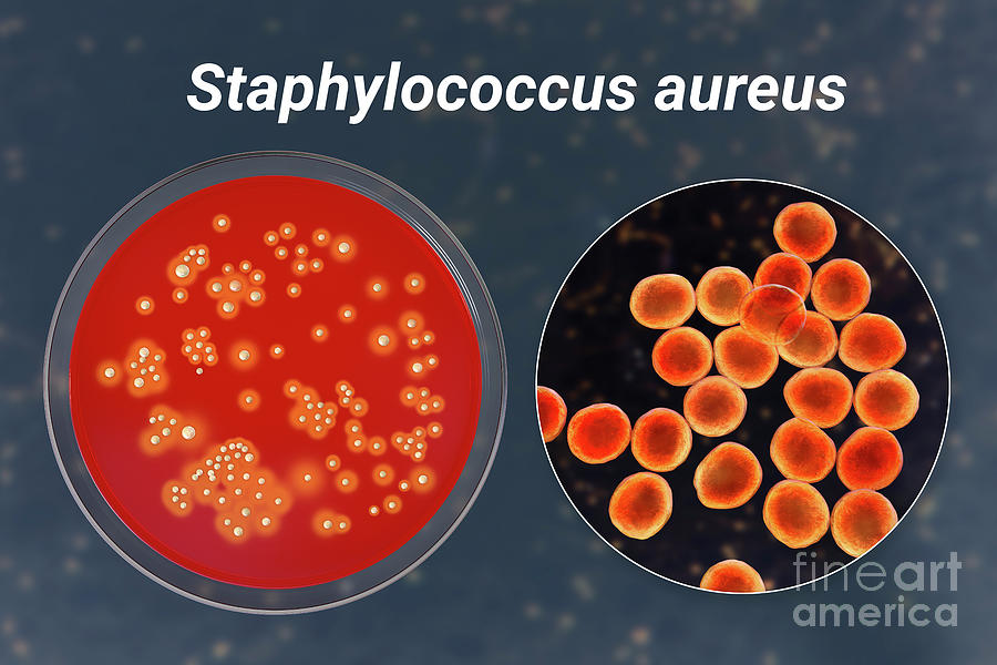 Premium Photo  Staphylococcus aureus antibiotic resistant bacteria