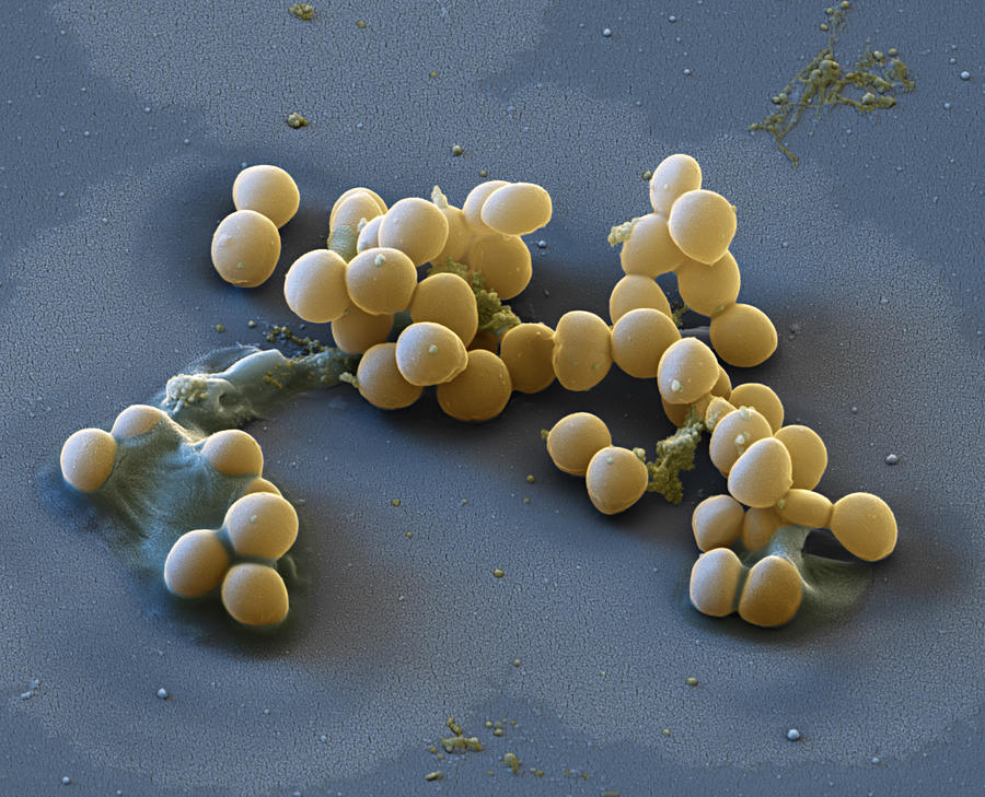 Staphylococcus Lugdunensis, Sem Photograph by Meckes/ottawa - Fine Art ...