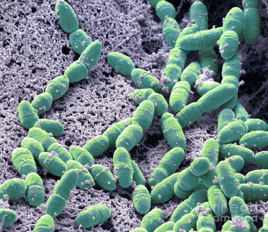 Streptococcus Mutans #4 Photograph by Steve Gschmeissner/science Photo Library