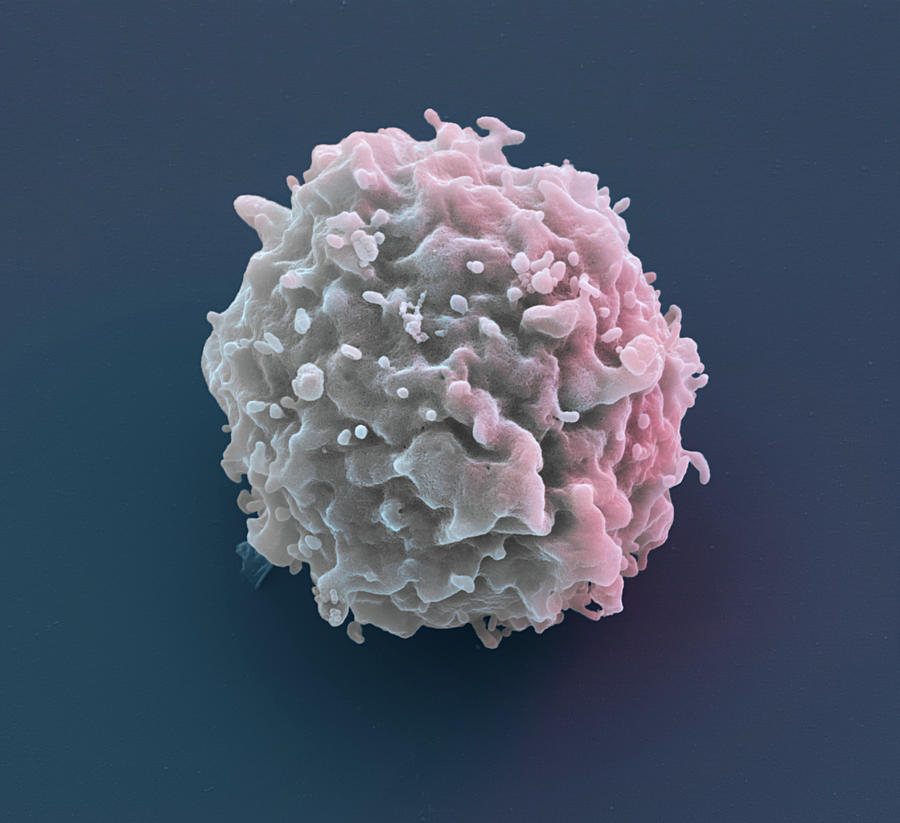 T Lymphocyte, Sem #4 Photograph by Oliver Meckes EYE OF SCIENCE
