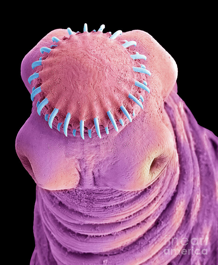 Tapeworm Cysticercus Photograph by Steve Gschmeissner/science Photo ...