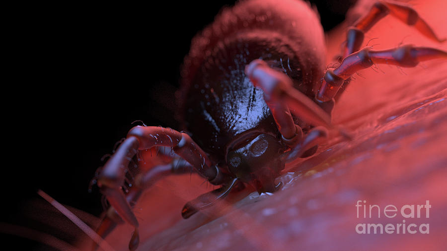 Tick Biting Human Skin Photograph by Sebastian Kaulitzki/science Photo ...