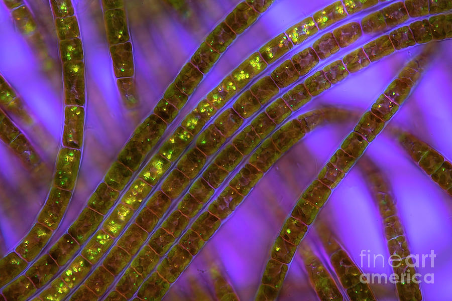 Tribonema Algae Photograph by Frank Fox/science Photo Library - Fine ...