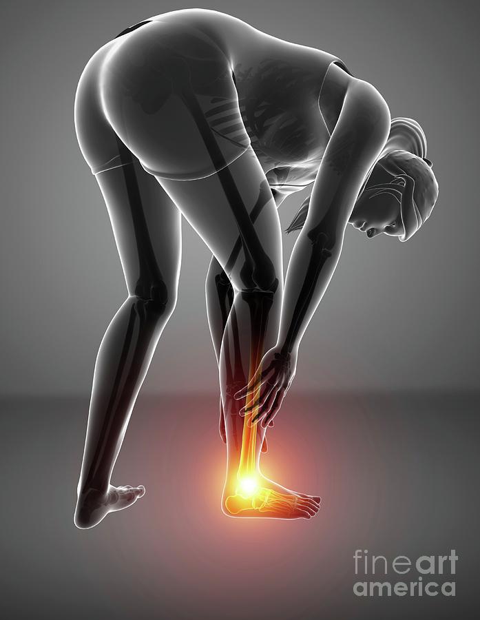 Woman With Foot Pain #4 by Pixologicstudio/science Photo Library