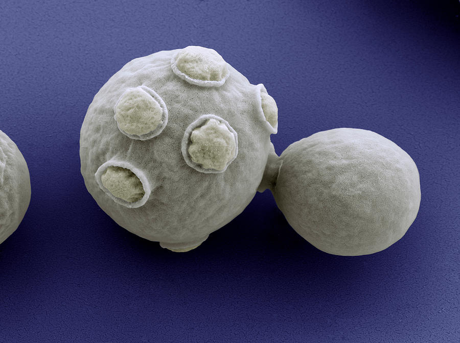 Yeast Cells Sem #4 Photograph by Meckes/ottawa