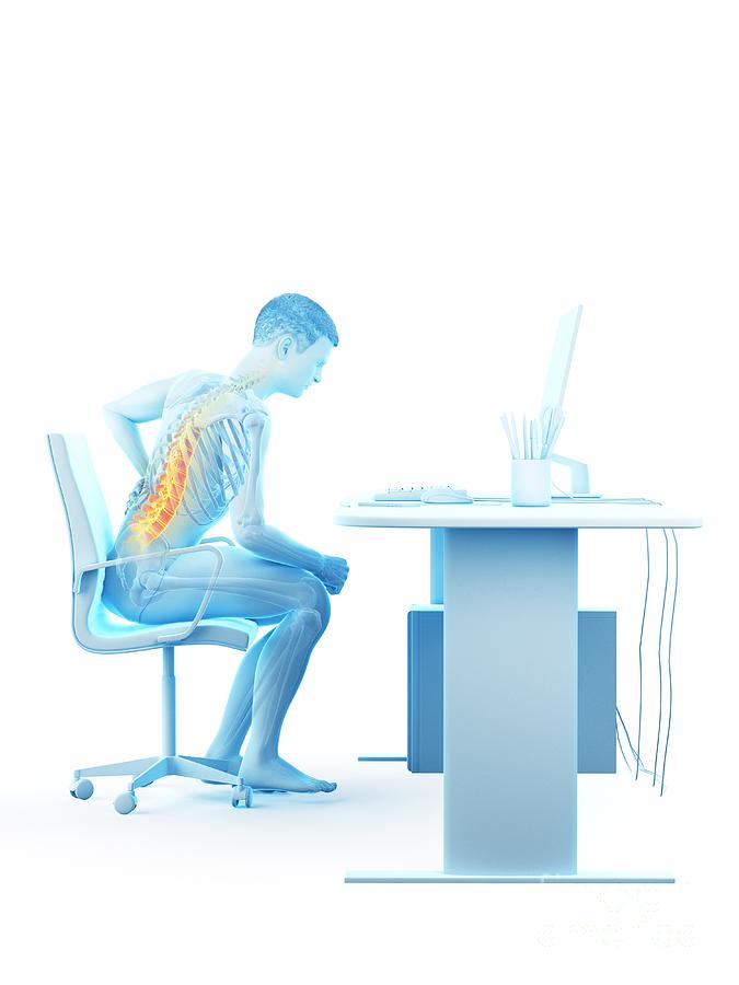 Back Pain Due To Sitting Photograph by Sebastian Kaulitzki/science ...