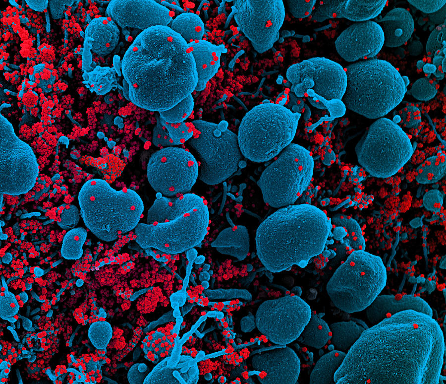 Sars-cov-2, Covid-19 Virus, Sem Photograph by Science Source - Fine Art ...