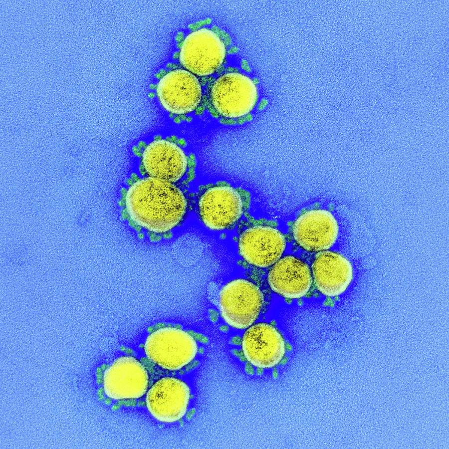Sars-cov-2, Covid-19 Virus, Tem #40 Photograph by Science Source