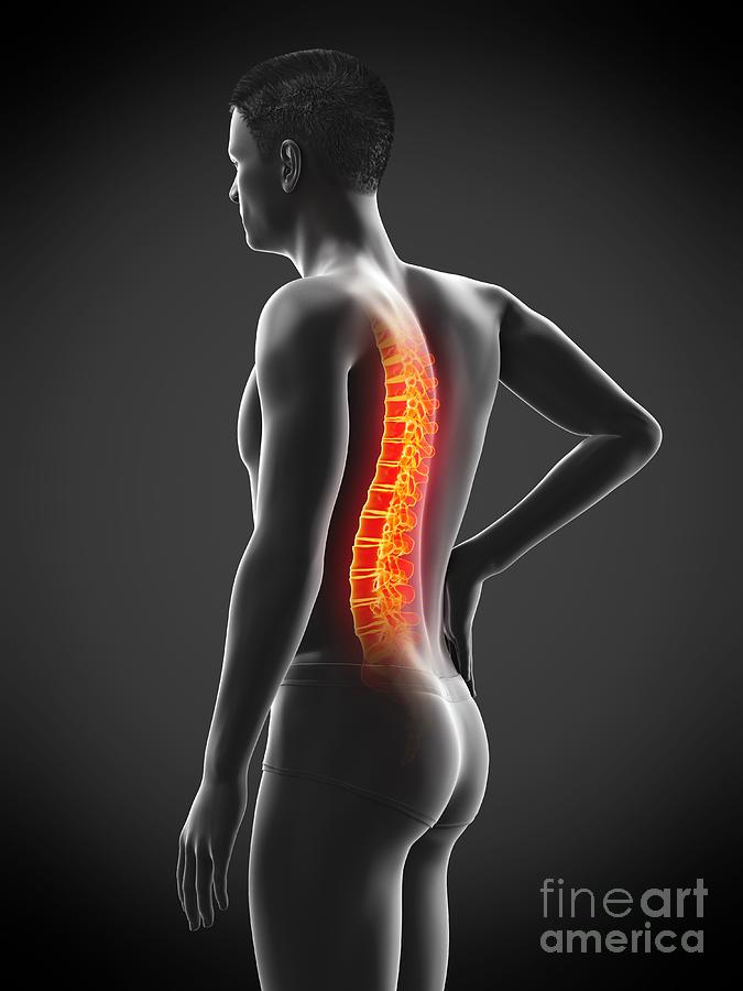 Skeleton Photograph - Back Pain #41 by Sebastian Kaulitzki/science Photo Library