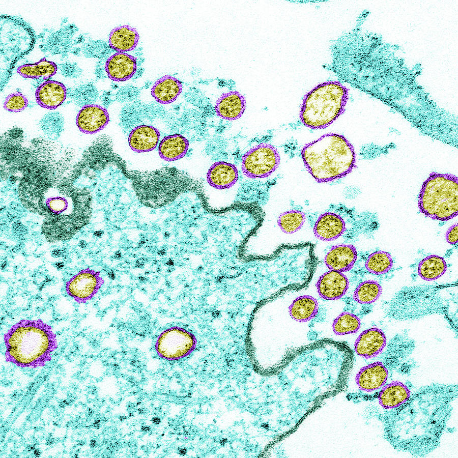 Sars-cov-2, Covid-19 Virus, Tem #41 Photograph by Science Source