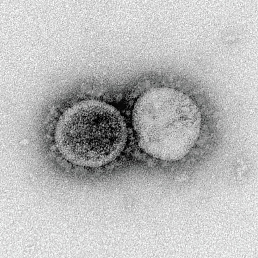 Sars-cov-2, Covid-19 Virus, Tem #42 Photograph by Science Source