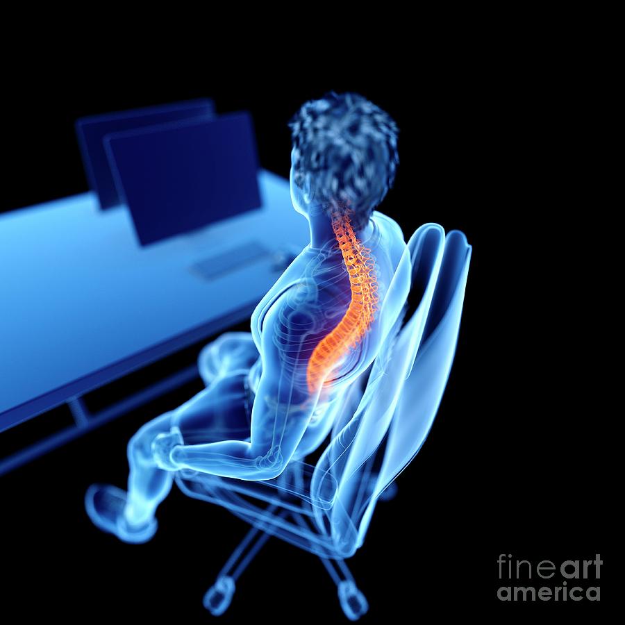 3d Photograph - Office Worker With Back Pain by Sebastian Kaulitzki/science Photo Library 3d Photograph - Office Worker With Back Pain by Sebastian Kaulitzki/science Photo Library